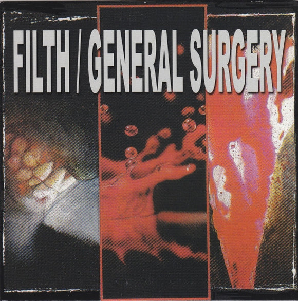 FILTH / GENERAL SURGERY - SPLIT - EP