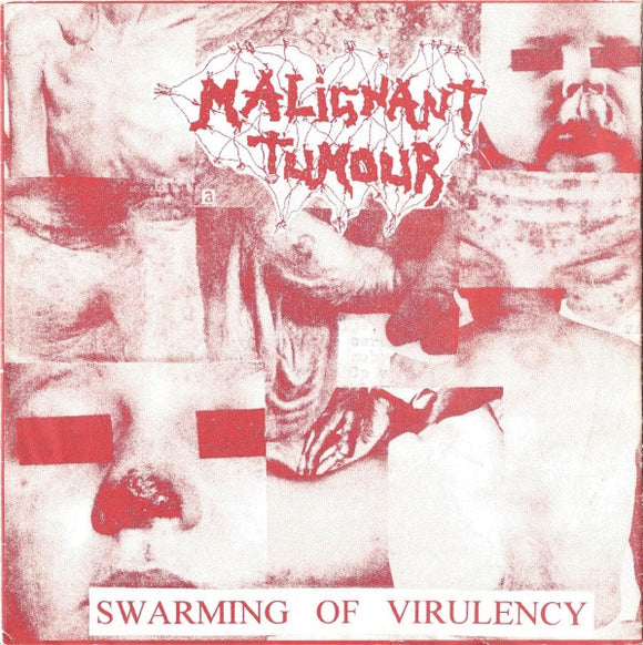 MALIGNANT TUMOUR/INGROWING - SPLIT - EP